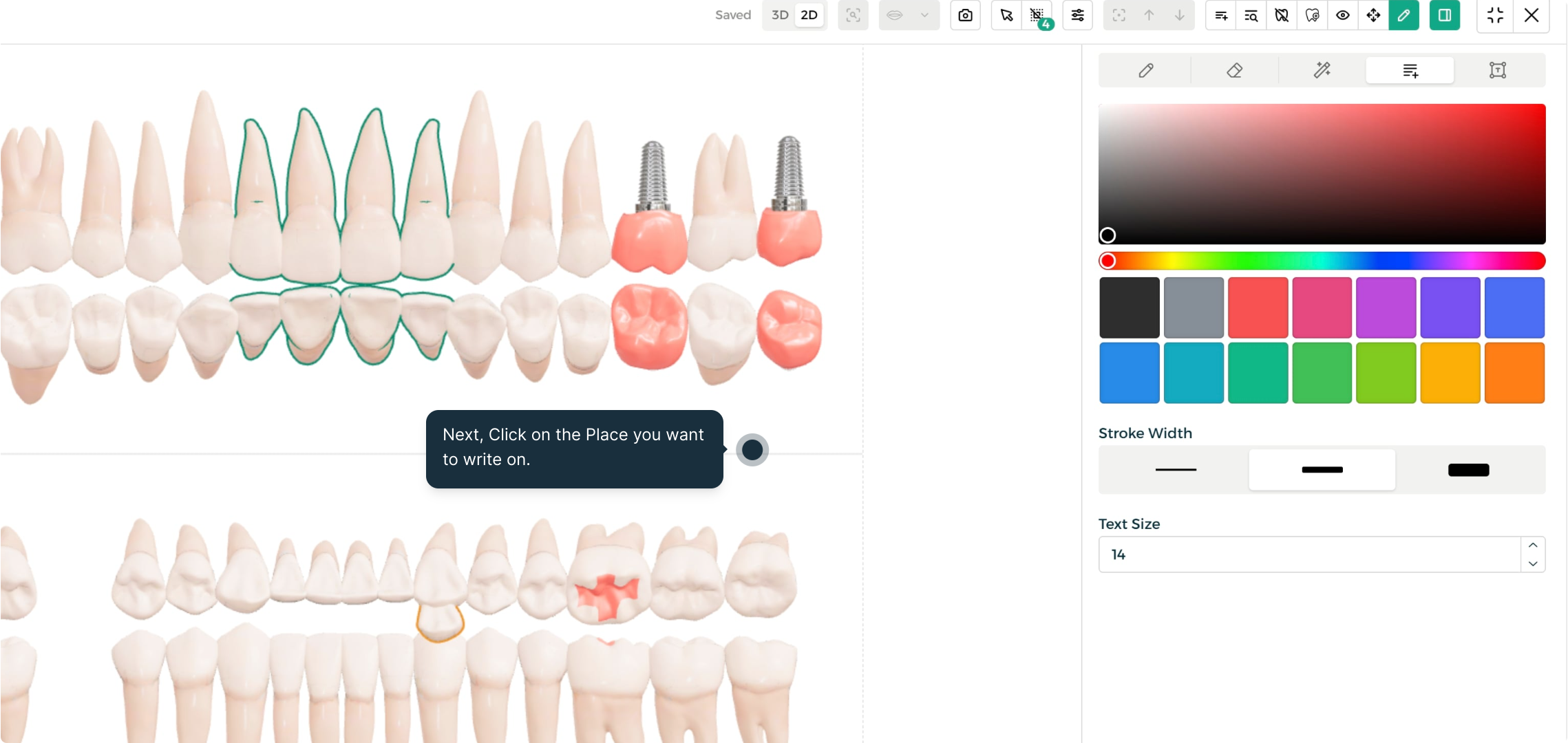 Step 4 - Add a text annotation